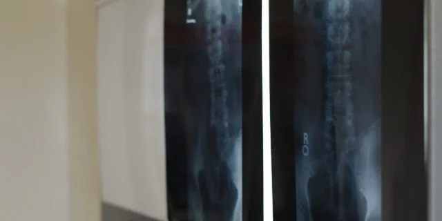 ウオッカ第二仔ケースバイケース骨盤にヒビで引退、繁殖入り